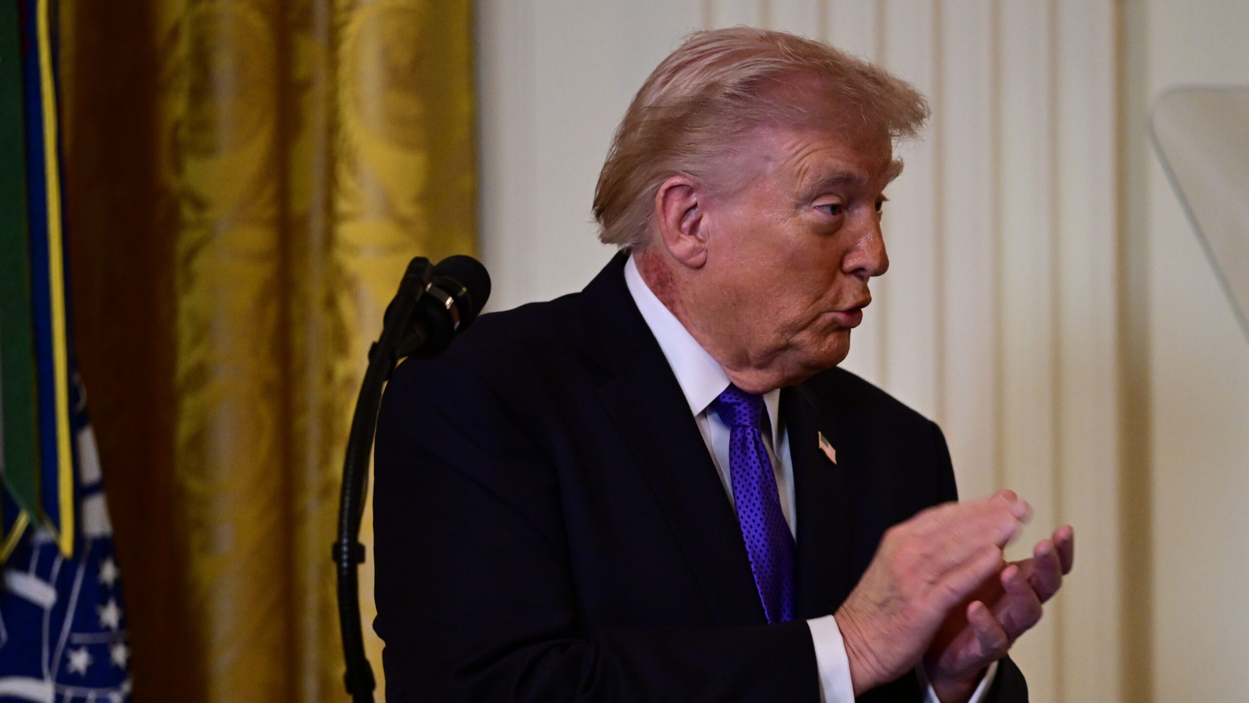 Trump aparece com pescoço vermelho em evento; médico esclarece causa