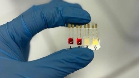 USP cria biossensor barato que detecta câncer de pâncreas rapidamente