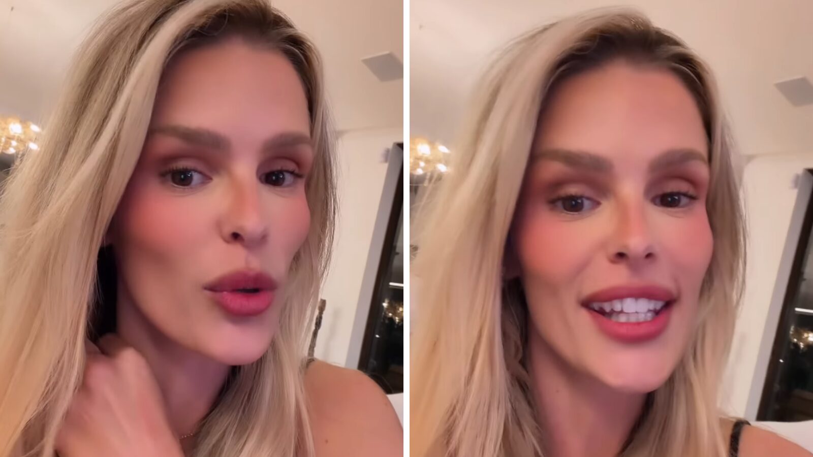 Yasmin Brunet revela que descobriu lipedema de forma inusitada