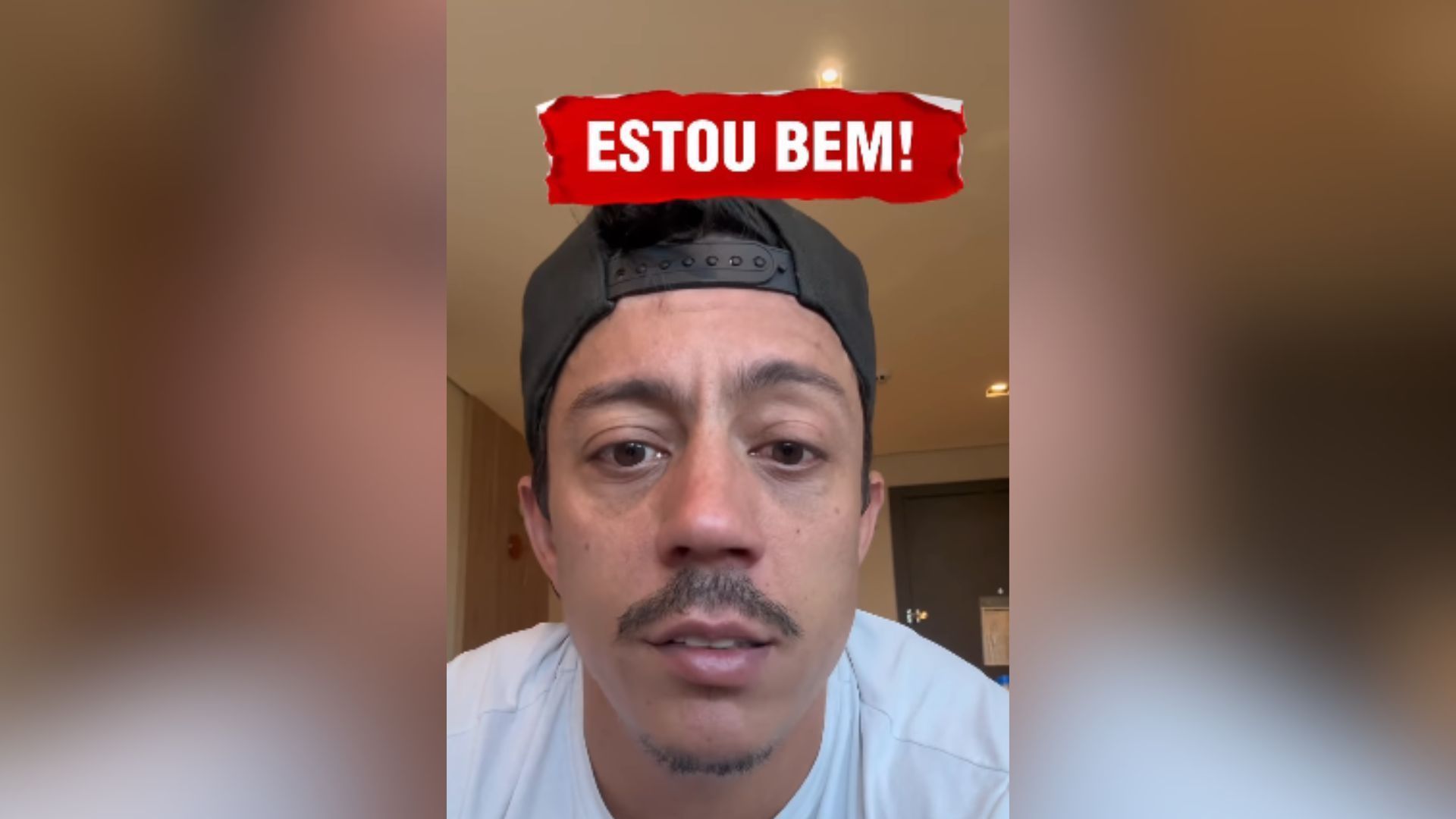 Paralisia de Bell: famosos que superaram essa condição