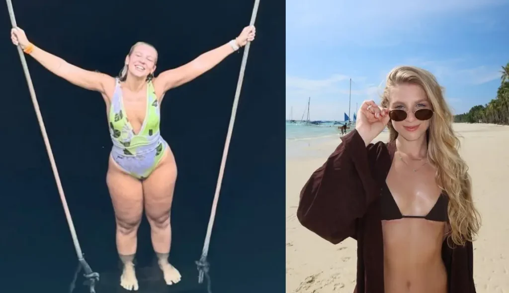 Lauren Pfeiff relata um ano de cirurgia de lipedema: mudanças significativas