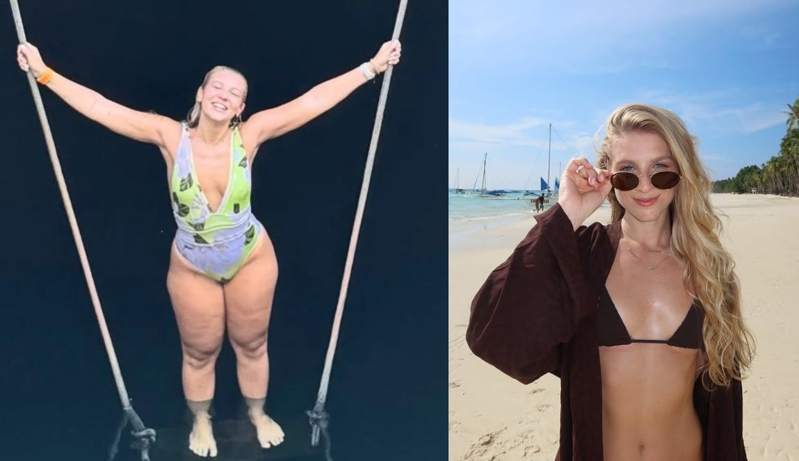 Lauren Pfeiff relata um ano de cirurgia de lipedema: mudanças significativas